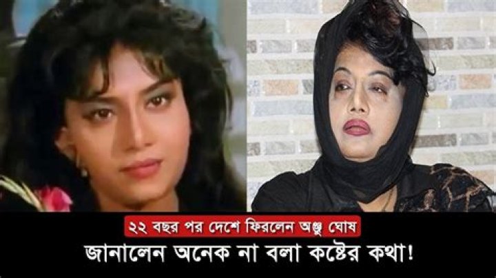 Anju Ghosh Plastic Surgery: Before And After Photo