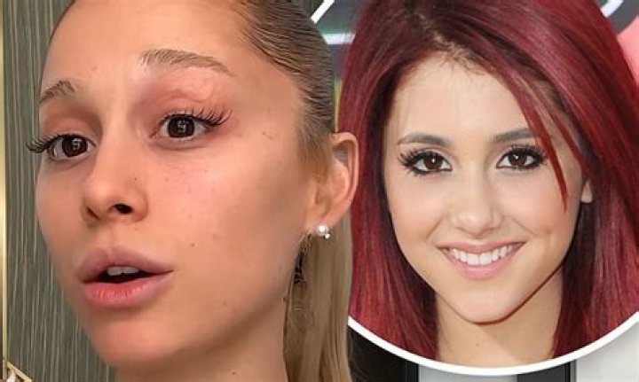 Ariana Grande's changing face was down to years of 'a ton of lip filler and Botox'