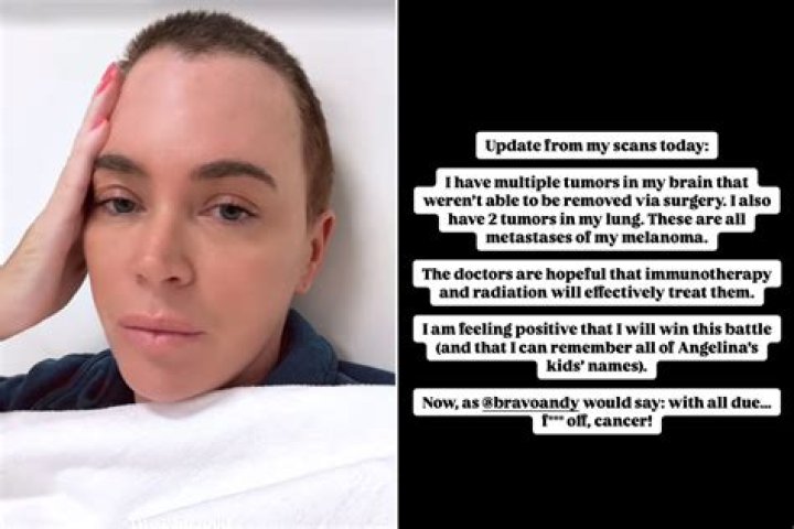 Teddi Mellencamp Gives New Health Update About Melanoma Diagnosis